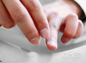 乳房针灸图片大全,穴位定位与养生保健指南