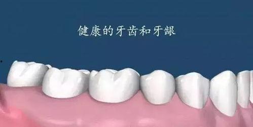 洗牙视频全过程,从准备到结束的全方位体验