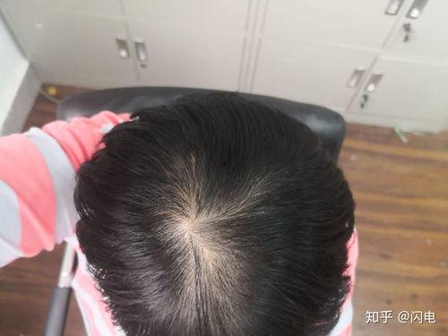 头顶图片,揭秘神秘天象背后的科学奥秘