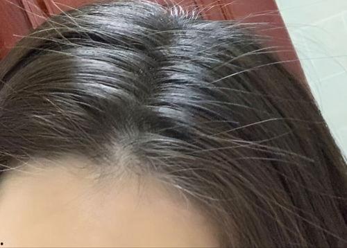 头顶图片,揭秘神秘天象背后的科学奥秘